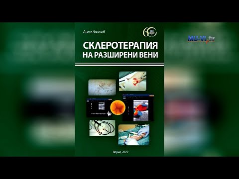 Видео: Склеротерапия на разширени вени