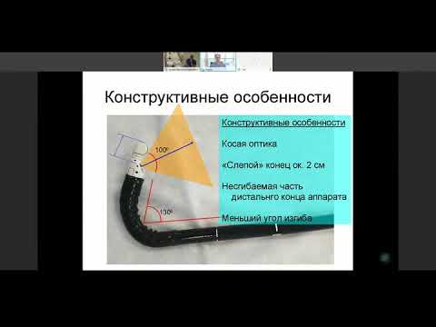Видео: ЭУС панкреато-билиарной зоны (Солоницын Е.Г., Поддымова А.В.)