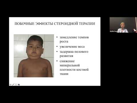Видео: Пациенты с миодистрофией Дюшенна. Эндокринологические аспекты