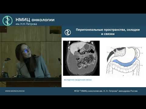 Видео: КТ в диагностике карциноматоза брюшины  Как мы это делаем