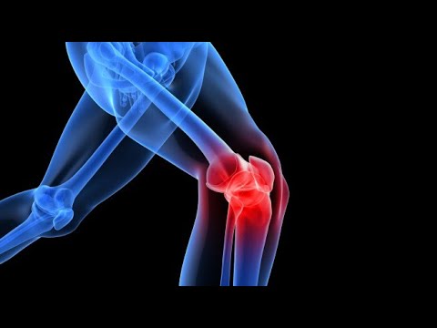 Видео: Ошибки эволюции: почему у нас слабые колени и кривые стопы