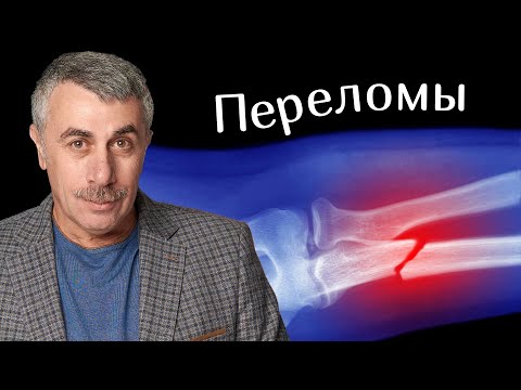 Видео: Переломы, первая помощь - Доктор Комаровский