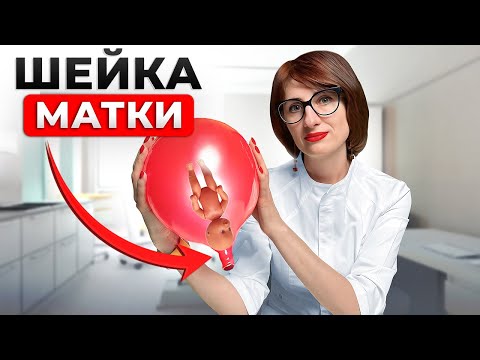 Видео: Раскрытие шейки матки: самостоятельно проверить и ускорить