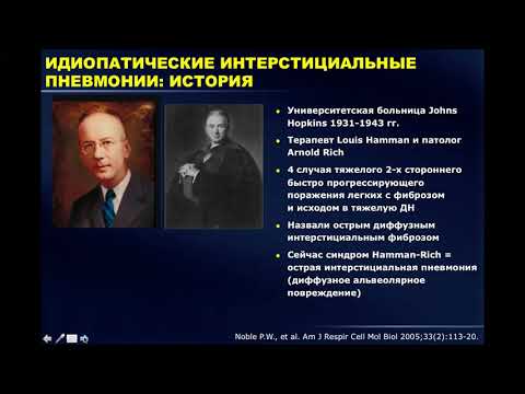 Видео: Интерстициальные болезни легких