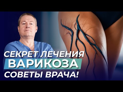 Видео: Причины ВАРИКОЗного расширения вен - и простые методы профилактики❗️