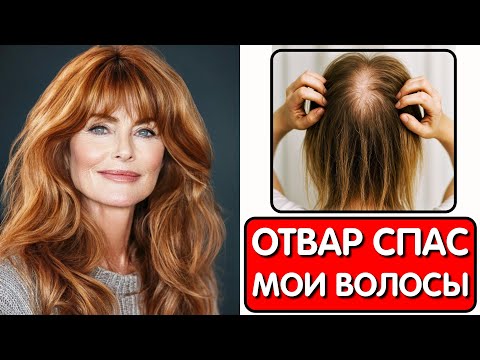 Видео: Простой ОТВАР СПАС МОИ ВОЛОСЫ ОТ ОБЛЫСЕНИЯ ! Волосы растут как сумасшедшие и больше НЕ ВЫПАДАЮТ !