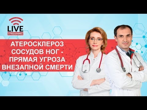 Видео: Атеросклероз ног - угроза внезапной смерти. Флеболог Москва.