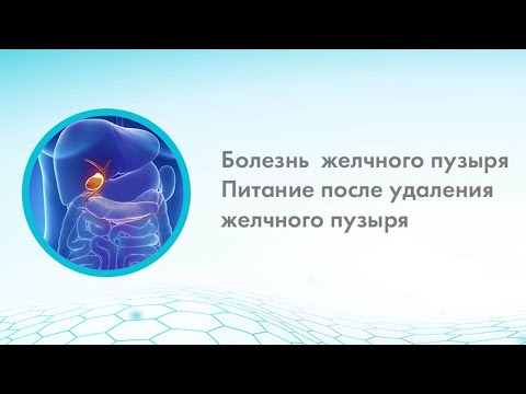 Видео: Болезнь желчного пузыря Питание после удаления желчного пузыря