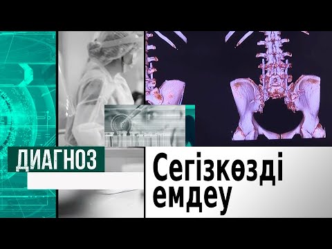 Видео: Сегізкөзді емдеудің ерекше әдістері туралы | Диагноз