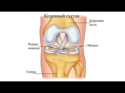 Видео: Несколько тестов для оценки работы мениска. (Коленный сустав)