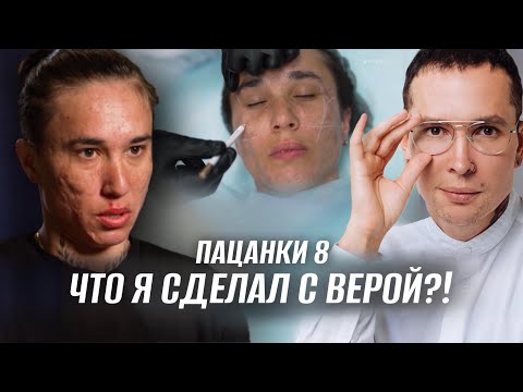 Видео: Что я сделал с Верой?! ПАЦАНКИ | Огромные рубцы постакне #пацанки8