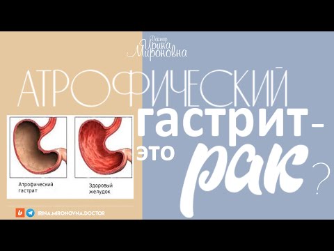 Видео: Атрофический гастрит- это рак?