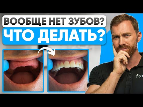 Видео: ДЕЛАЙТЕ ЭТО, если у вас нет зубов! Можно ли поставить импланты на все зубы?