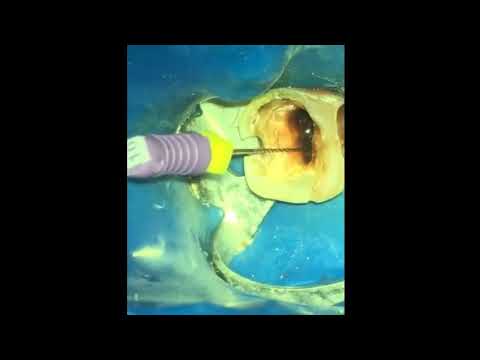 Видео: 2020-10-05 Как распломбировать резорцин.