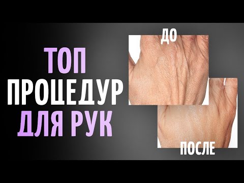 Видео: Эффективные процедуры для кожи рук