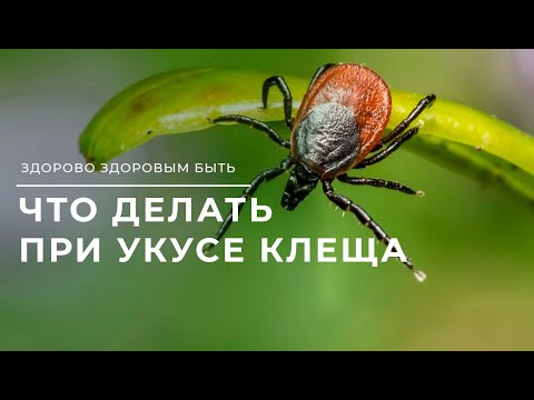 Видео: Как определить энцефалитный клещ или нет?