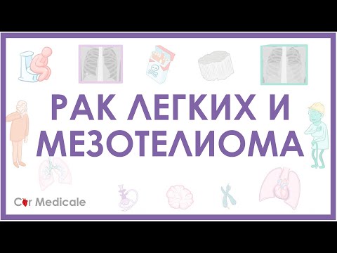 Видео: Рак легких и мезотелиома - причины развития, дифференциальная диагностика, принципы лечения и др.