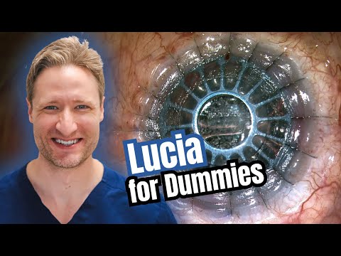 Видео: Сборка «нового» кератопротеза Lucia Boston — простое руководство