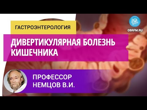 Видео: Профессор Немцов В.И.: Дивертикулярная болезнь кишечника
