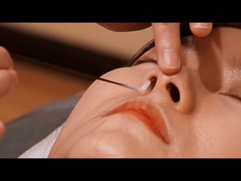Видео: Чистка носа ASMR китайского носа