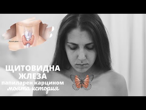 Видео: ЩИТОВИДНА ЖЛЕЗА | папиларен карцином | моята история