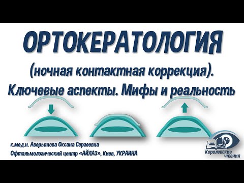 Видео: ОРТОКЕРАТОЛОГИЯ (ночная контактная коррекция). Ключевые аспекты. Мифы и реальность