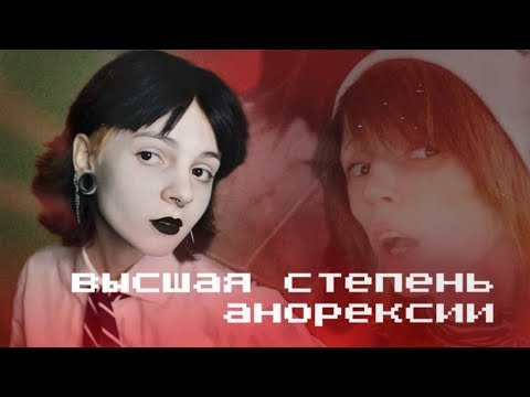 Видео: Она просто хотела быть худой, а получилось... Эшли Айзек