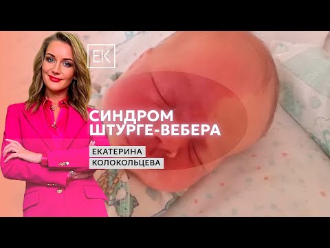 Видео: Синдром Штурге–Вебера: правильная постановка диагноза и лечение / Екатерина Колокольцева