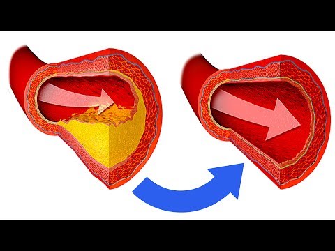 Видео: Давление будет 120х80! Просто Ешьте ЭТО. (Проверено Работает.)