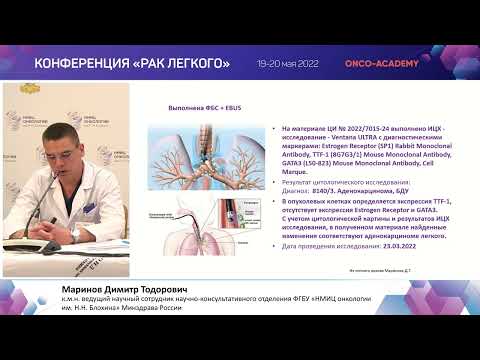 Видео: Правильное стадирование – первый шаг к успеху. Миниинвазивная диагностика. Маринов Д.Т.