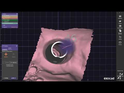 Видео: Тестирую EXOCAD GALWAY 3.0 коронка с винтовой фиксацией