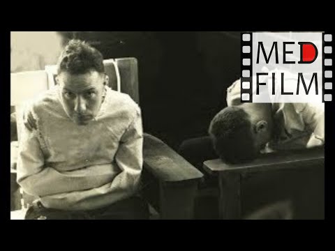 Видео: 1. Психические болезни (симптомы, синдромы) © Symptoms of mental sickness