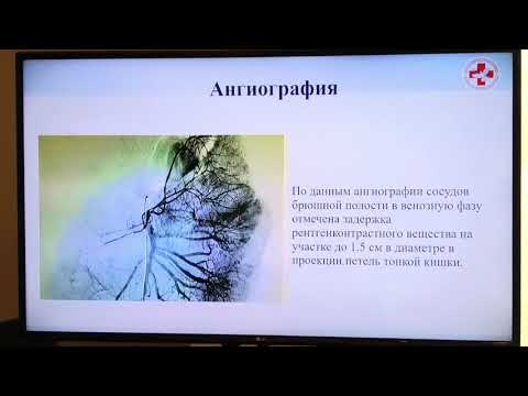 Видео: 13 Харитонова АЮ Необычные причины анемии у детей  Находки эндоскопистов