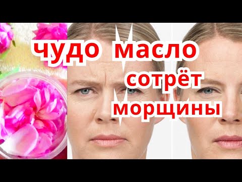 Видео: Золотое масло от морщин 🔥Морщины исчезли в 65 лет! Натуральный коллаген! масло розы