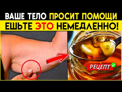 Видео: ВРАЧ: вот почему ВЫ ТЕРЯЕТЕ МЫШЦЫ ЕЖЕДНЕВНО! Как Остановить Дряхлость Мышц и Саркопению