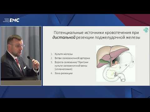 Видео: 19. Возможности рентгенэндоваскулярных методик в лечении желудочно-кишечных кровотечений — Тарханов