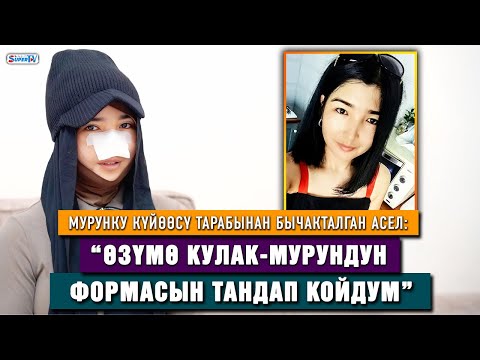 Видео: Мурунку күйөөсү тарабынан бычакталган Асел: “Өзүмө кулак-мурундун формасын тандап койдум”