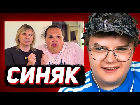 Видео: КАША СМОТРИТ: Игоря Синяка укусил шмель. Пытаемся исправить ситуацию
