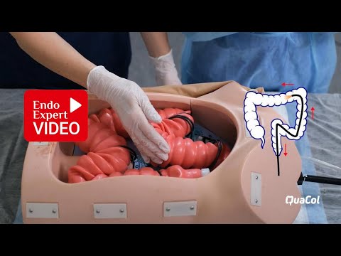 Видео: Видео-пособие «Важная роль медицинской сестры при колоноскопии» З.В. Галкова 2020