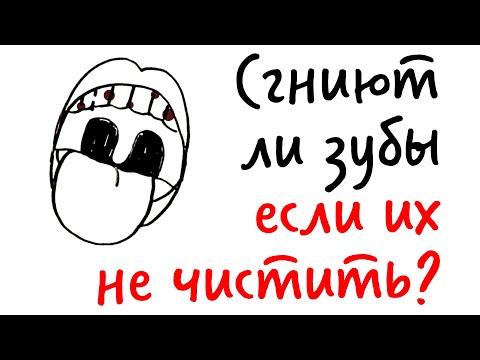 Видео: СГНИЮТ ЛИ ЗУБЫ, если их не чистить? — Научпок