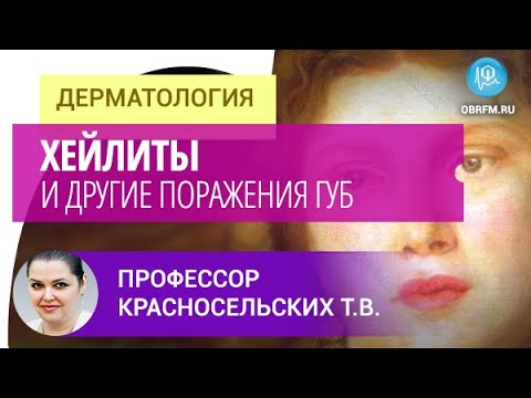 Видео: Профессор Красносельских Т.В.: Хейлиты и другие поражения губ