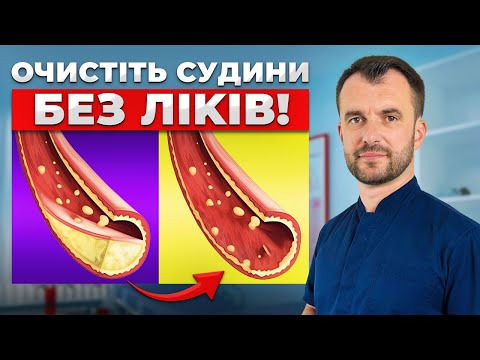 Видео: Як знизити холестерин? ПРОСТИЙ СПОСІБ позбутися від бляшок і тромбів.