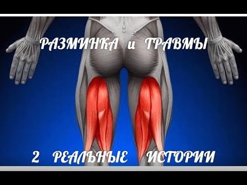 Видео: Травмы И Разминка - РЕАЛЬНЫЕ ИСТОРИИ из ЖИЗНИ