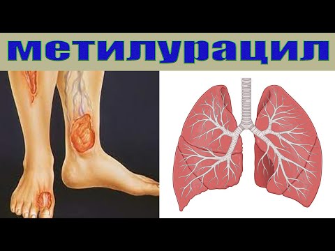 Видео: Метилурацил- лекарство от язвы желудка, панкреатита, гепатита, анемии, геморроя, трофических язв