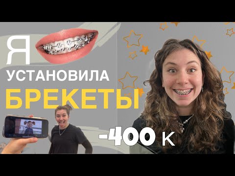 Видео: Я ПОСТАВИЛА БРЕКЕТЫ и удалила зубы *очень больно*