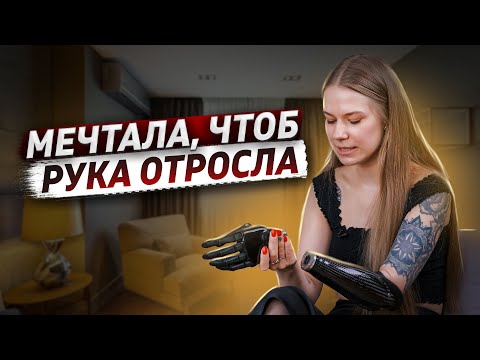 Видео: Родилась без руки | Катя Крюк