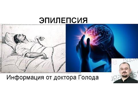 Видео: Эпилепсия