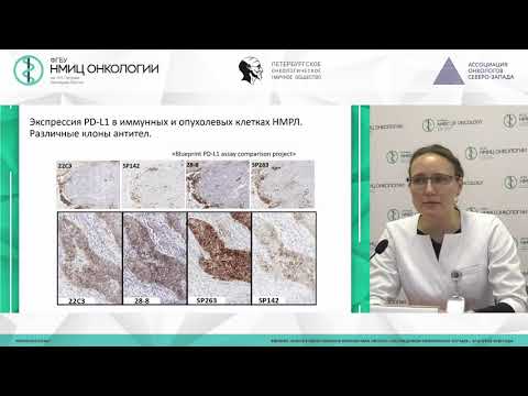 Видео: Рекомендации по PDL – тестированию немелкоклеточного рака легкого (НМРЛ)