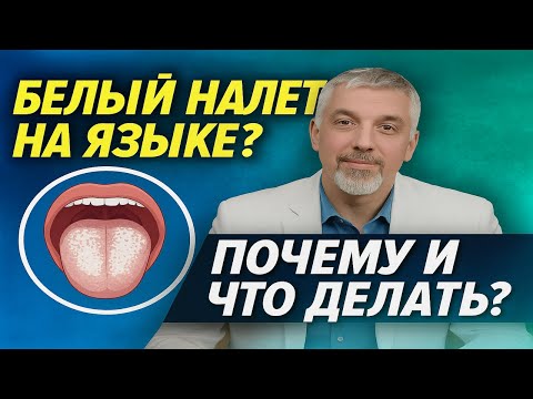 Видео: Белый Налет на Языке  Почему и что делать