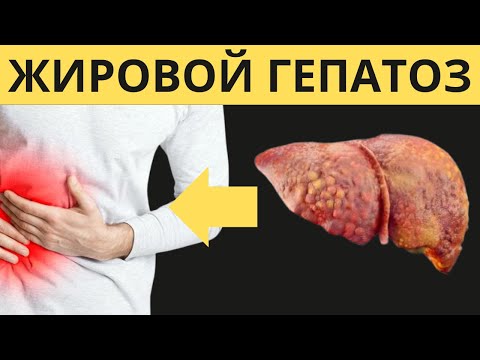Видео: Бауыр майлануы емдеу жолдары. Үй жағдайнда қалай емдеу керек Жировой гепатозды